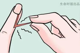 「长倒刺」的真正原因多数人不知道，简单3步无痛除倒刺图片