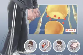 这5种走路姿势，藏着疾病秘密！第2种你可能也有图片