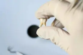 被10亿人忽视的口腔问题，正悄悄瓦解「全身系统」图片