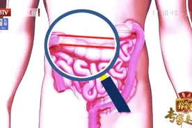 容易便秘、腹泻？小心肠道老化了！调理肠道两步走，为肠道“减龄”添活力图片