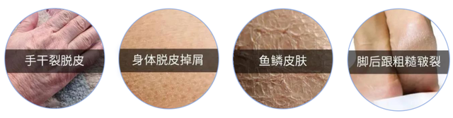 南方抹身体乳吗