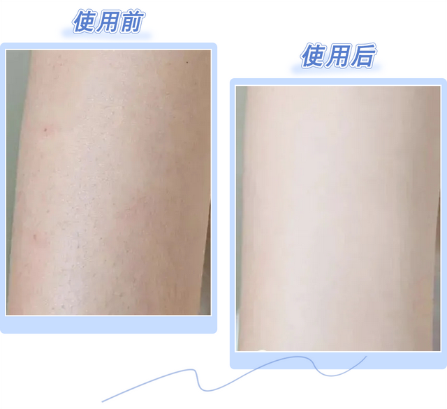 南方抹身体乳吗