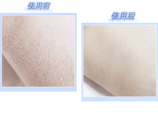 南方抹身体乳吗