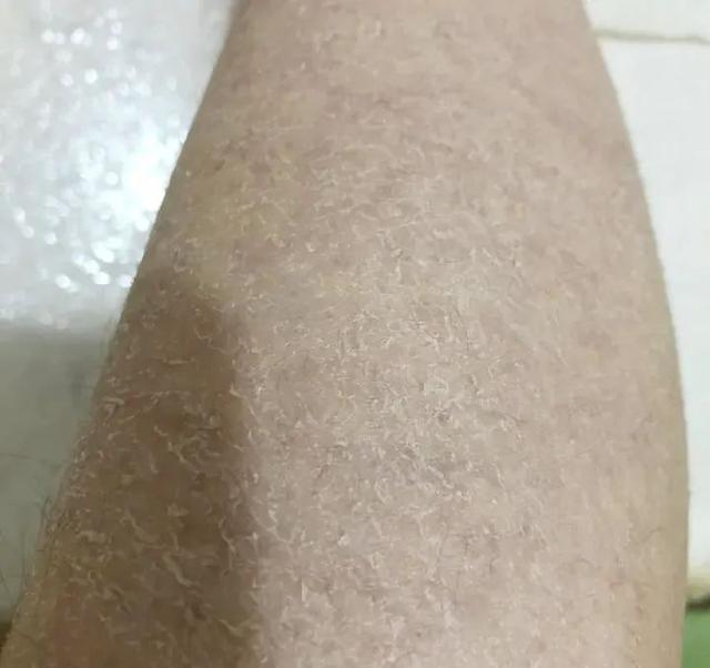 南方抹身体乳吗