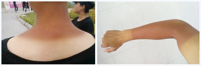 南方抹身体乳吗