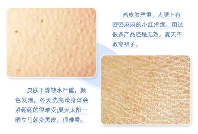 南方抹身体乳吗