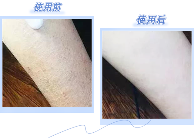 南方抹身体乳吗