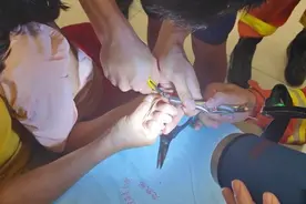 “我都不痛，你紧张啥”6岁女童手卡钢管反安抚救援人员图片