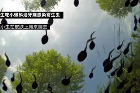 阿姨每天生吃小蝌蚪，只为治牙痛！一查发现感染寄生虫图片