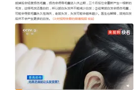 涨知识！长了白头发能拔掉吗？图片
