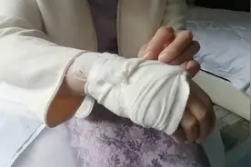 淋浴室玻璃门突然碎了，女子入住酒店全身被多处划伤视频封面