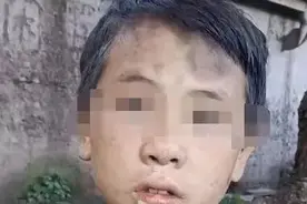 “贫困孩童”视频流传，官方：是摆拍图片