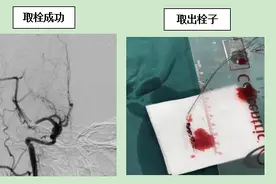 重医二院·聚焦前沿｜第62期 卒中中心：打通生命“绿色通道”，多学科“联动”救治患者图片