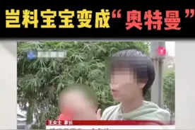 婴儿头型矫正？该矫正“畸形育儿观”了图片