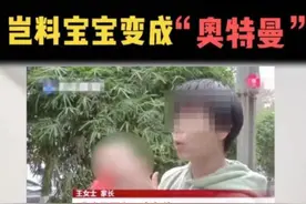 婴儿头型矫正？该矫正“畸形育儿观”了图片