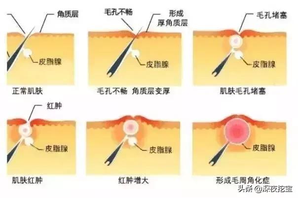 菲丝蔻水光身体乳好用吗 菲丝蔻水光身体乳好用吗