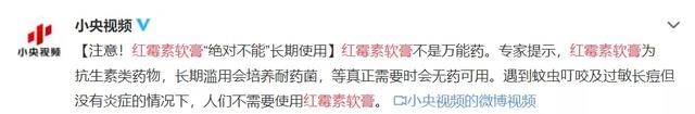 嘴角化脓用什么贴贴 嘴角化脓用什么贴贴