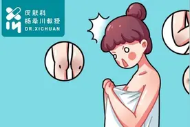为何从未见天日的屁股会有两团黑？图片