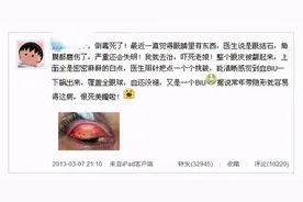 美瞳并不一定都是美，佩戴需注意图片