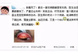 美瞳并不一定都是美，佩戴需注意图片