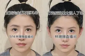 卷生卷死的网红们连耳朵都是整的？人均精灵耳逼疯脸盲症…图片