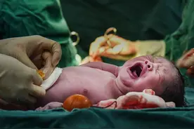 宝宝剪脐带时疼不疼？一出生就哭是真疼还是害怕，看完就知道了图片