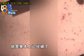 男子体验分娩阵痛，到6级后肚皮受伤！​小两口质疑仪器存在问题图片