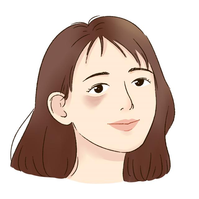 鼻根脂溢性角化病