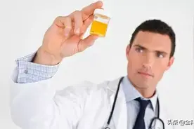 小便时有很多泡沫，是蛋白尿吗？本文告诉你答案图片