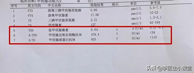 甲状腺炎能治疗好吗（常见的桥本氏甲状腺炎）
