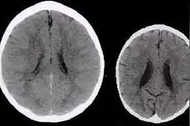 “棍棒”成才的孩子，受伤不止是身体，还有智商发展图片