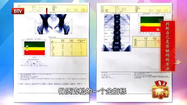补钙补不对,小心惹出一身病!正确补钙、补维生素D,先看缺不缺