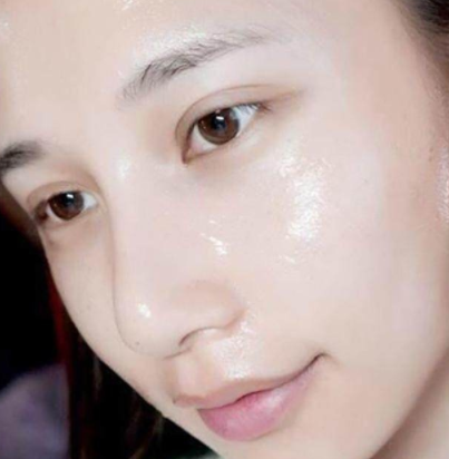 女人脸部下垂，别急着打玻尿酸，简单一招肌肤紧致有弹性