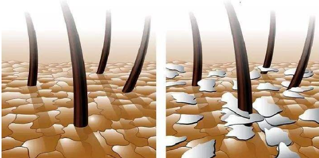 鎴戝浗鈥滈粯榛樻棤闂烩€濈殑娲楀彂姘达紝骞充环鍙堝ソ鐢紝缃戝弸锛氱敤瀹屽ご鍙戞洿濂戒簡