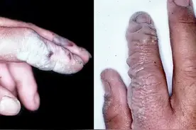 现实版“化骨水”，状如清水却能蚀骨，被标注成“弱酸”让人忽视图片