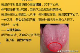 治疗失眠的中成药大总结，失眠、多梦、入睡困难再也不怕用错药图片