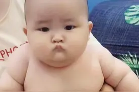 1岁宝宝喝母乳后体重30斤，浑身肉坨，医生担忧：可不是好兆头图片