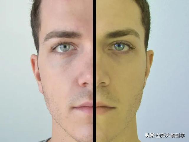 肝脏主要功能及损伤表现