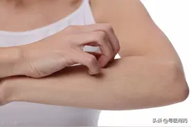 对女朋友体液过敏？盘点奇怪的过敏源图片