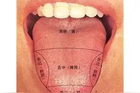 舌头出现这种变化，暗示你的身体可能出了“大毛病”，需尽早治疗图片