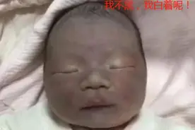 “黑脸宝宝”被亲妈嫌弃，护士却夸好看，2个月后高颜值逆袭图片