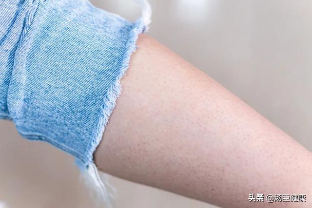 结婚时手臂鸡皮肤