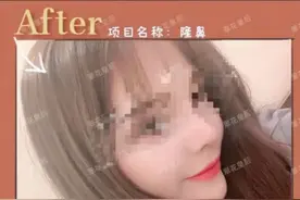 流量平台医美营销新套路：一杯奶茶钱帮看脸，专人陪同整形图片