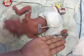 出生时仅1斤，比一瓶矿泉水还轻！如今，“手掌宝宝”长这样图片