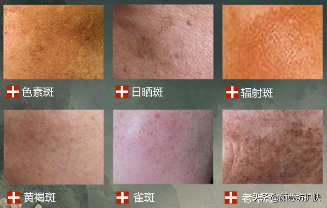 脸部出现了这些症状，说明你需要给脸部排个毒了