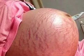 高龄产妇孕检出龙凤胎，高高兴兴生下来连称自己上当了图片