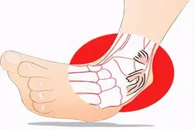 扭伤脚后，浙江25岁已婚姑娘发现：自己竟然是个男人！到底啥情况？图片