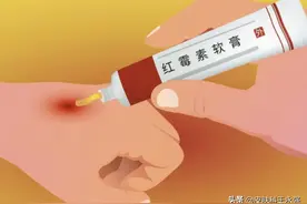 几块钱一支的红霉素软膏，解决皮肤病人的烦恼，早知早用早好图片