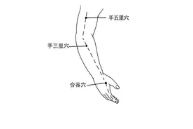 手三里主治：霍乱遗矢，失音气，齿痛，颊颔肿，瘰疬，手臂不仁图片