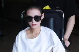 王思聪前女友张予曦现身，拍戏受伤坐轮椅露面，分手后事业攀升图片